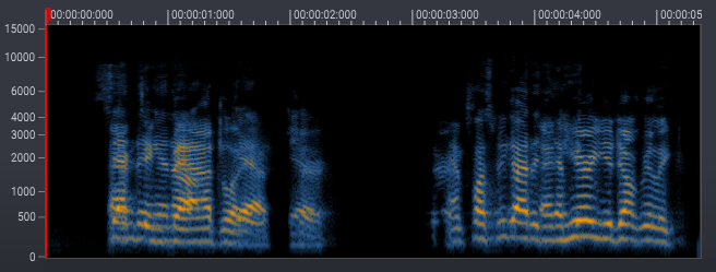 processed-spectrogram