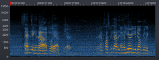 Deep learning for audio applications